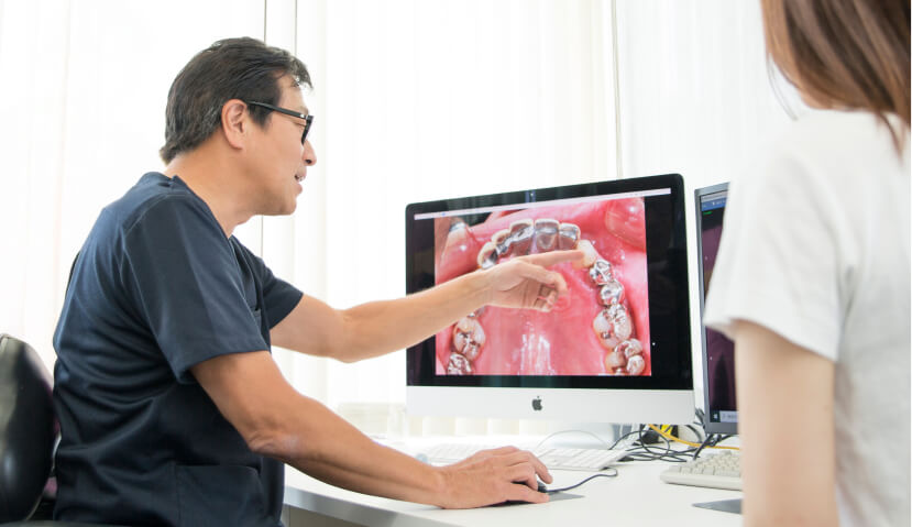 インプラント専門医によるカウンセリング