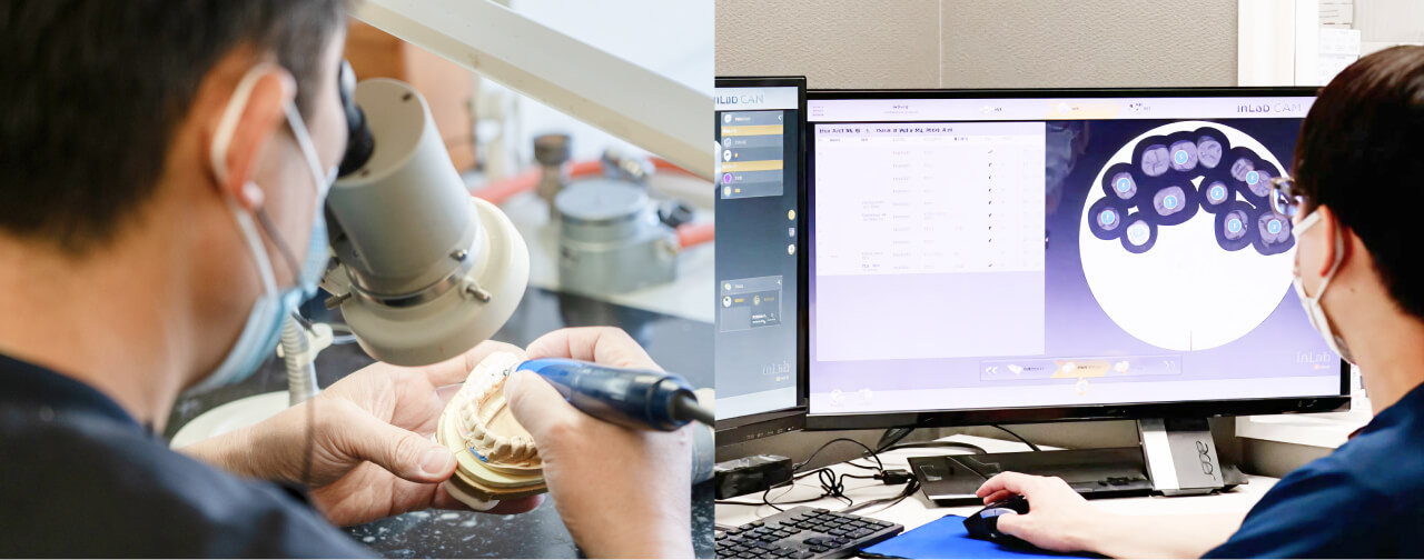 院内歯科技工所チーム