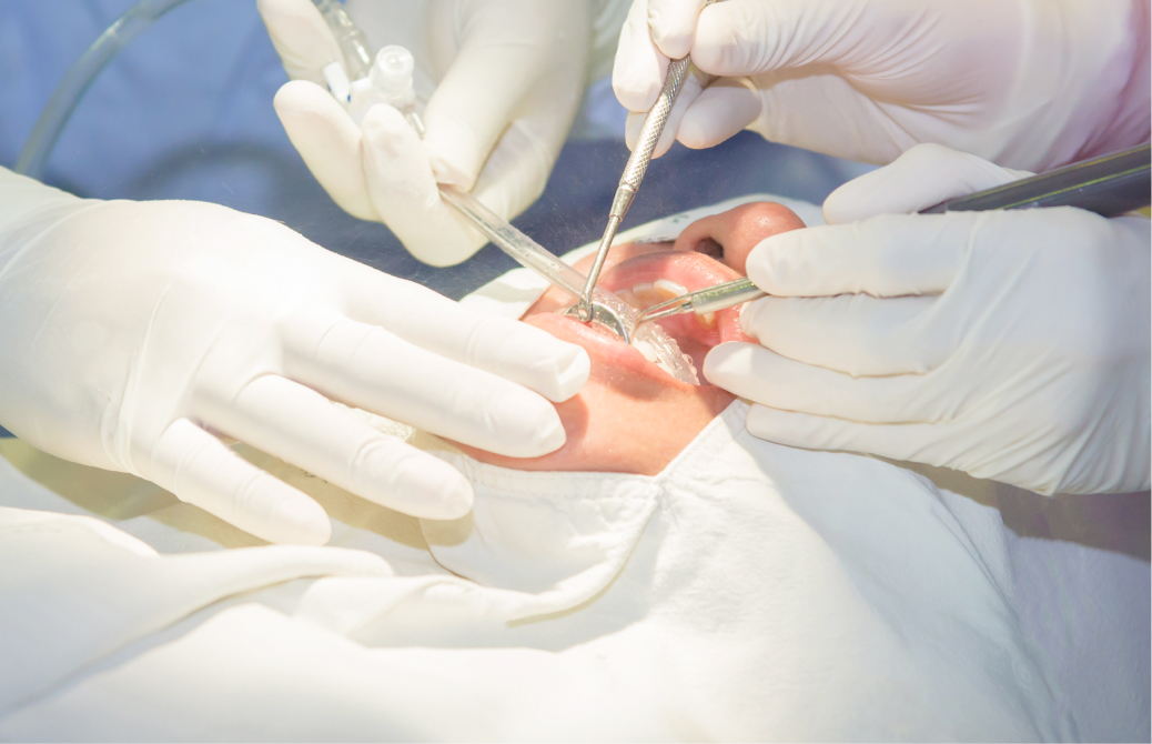 インプラントのリカバリー手術