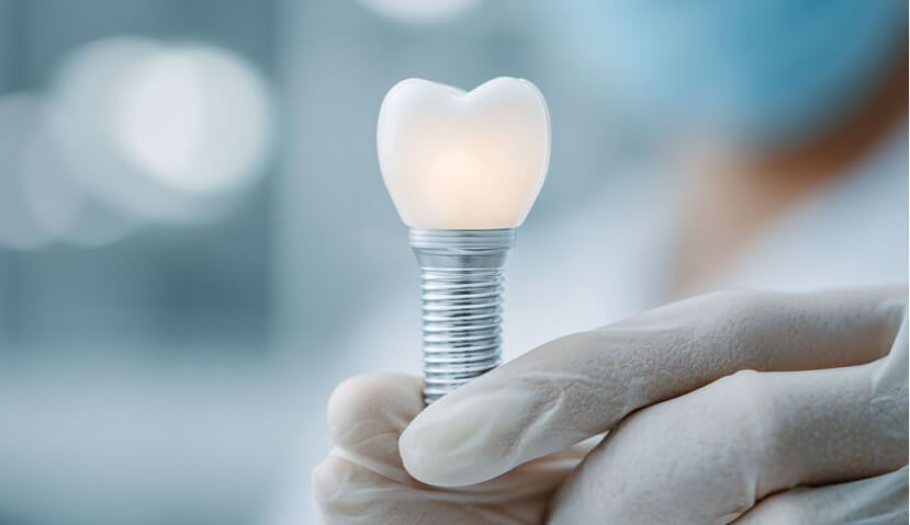 インプラントを持つドクター