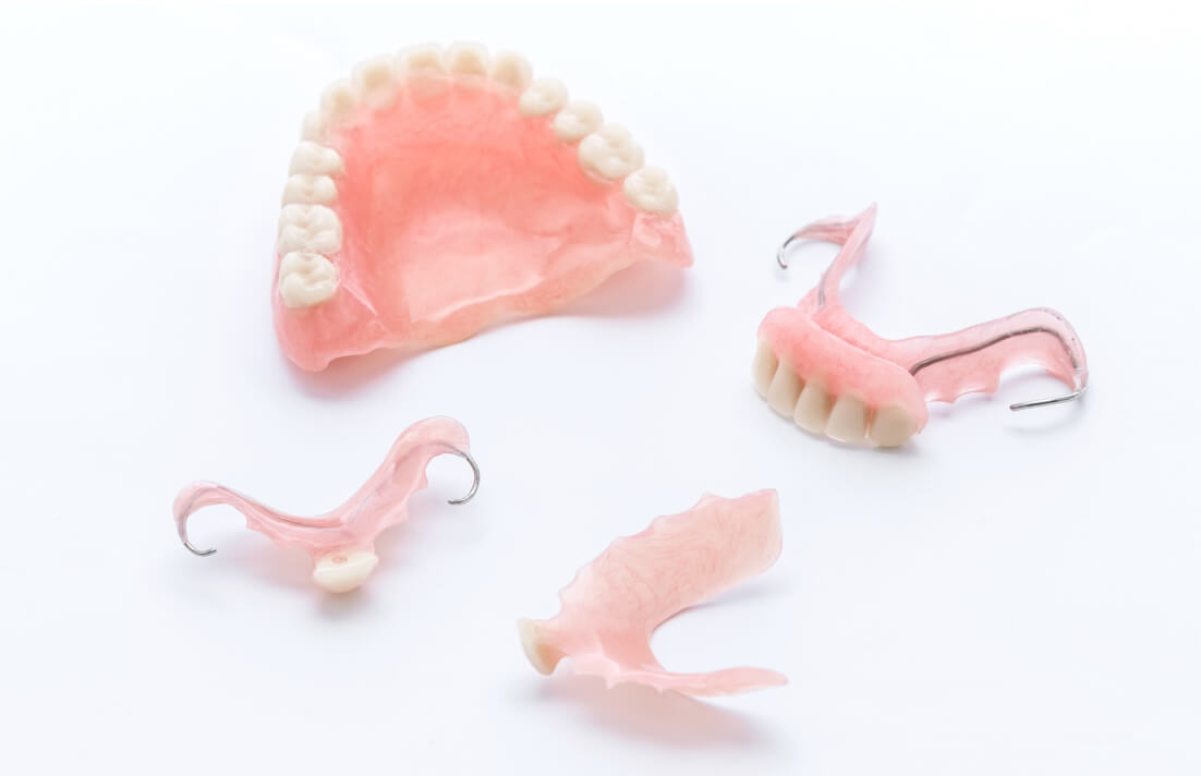 ブリッジや入れ歯