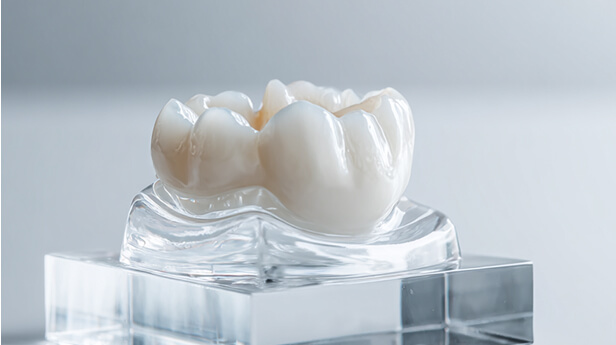 上部構造（人工歯）