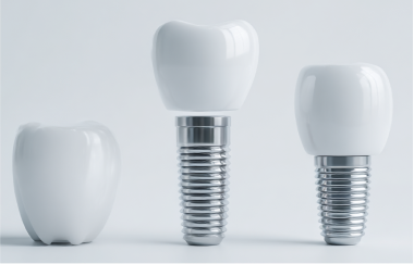 3種類のインプラントの写真