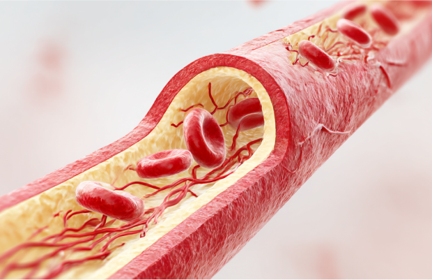 歯周病菌が血液に入るイメージ