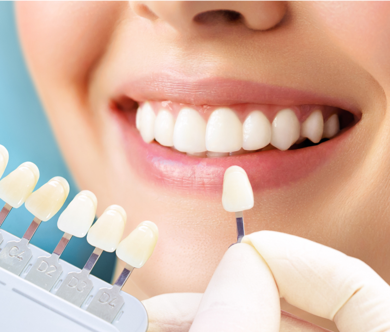 予防歯科の様子