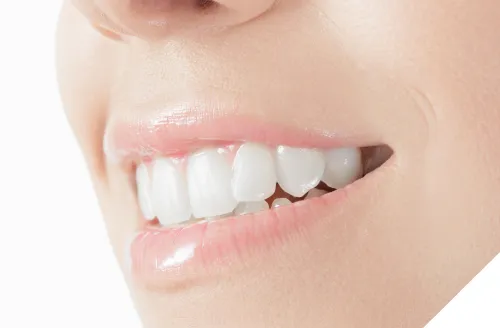 インプラント治療をした男性の口元