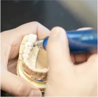 技工士による人工歯の作成