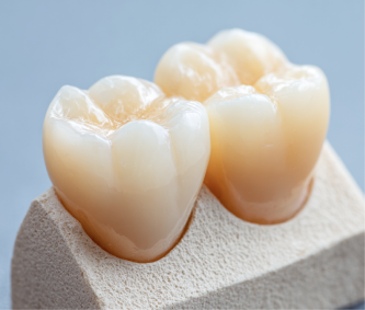 ジルコニアクラウン