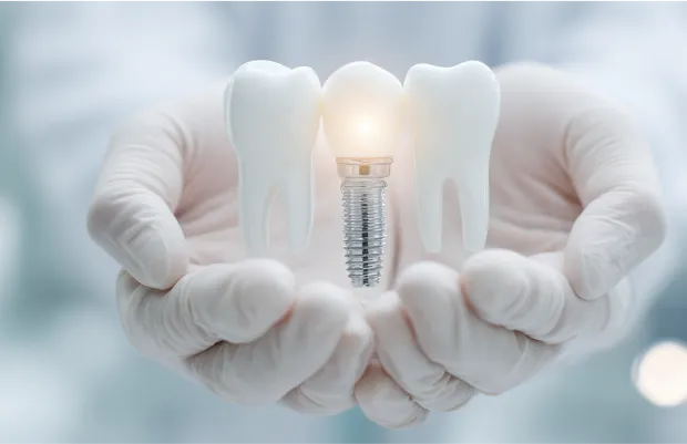 インプラントを持つドクター